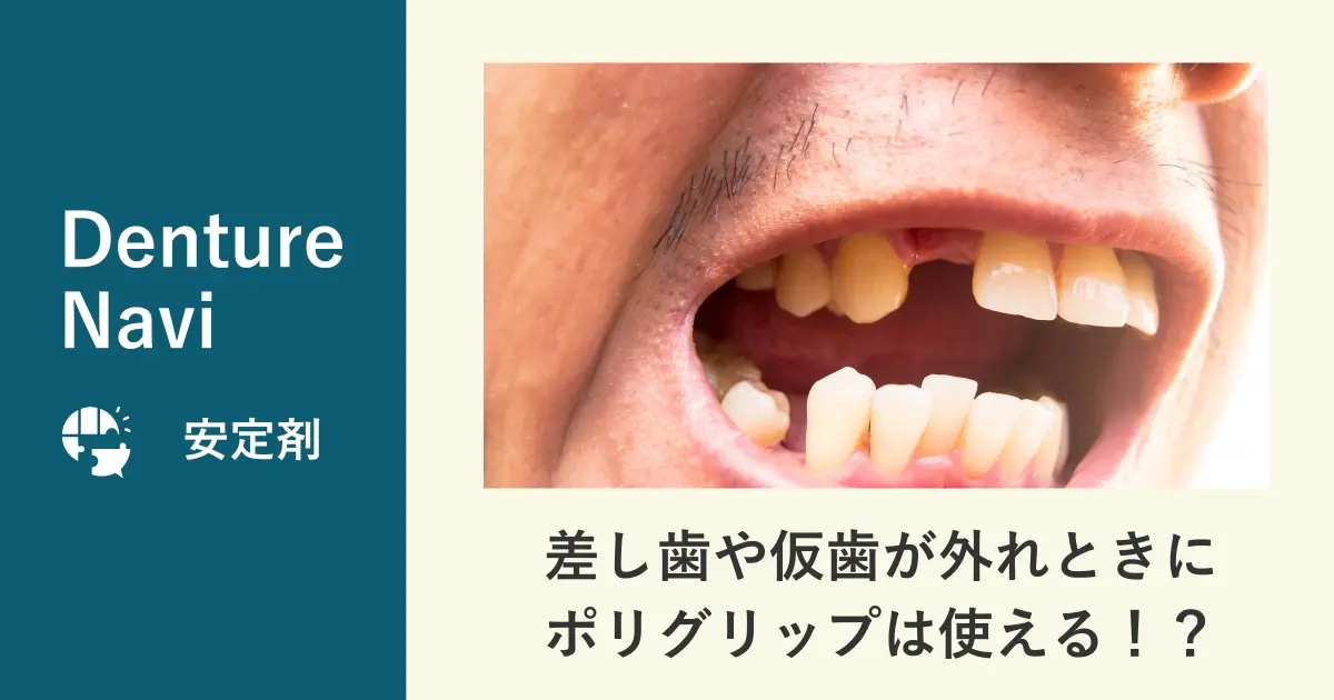 差し歯や仮歯が外れたときにポリグリップは使える！？