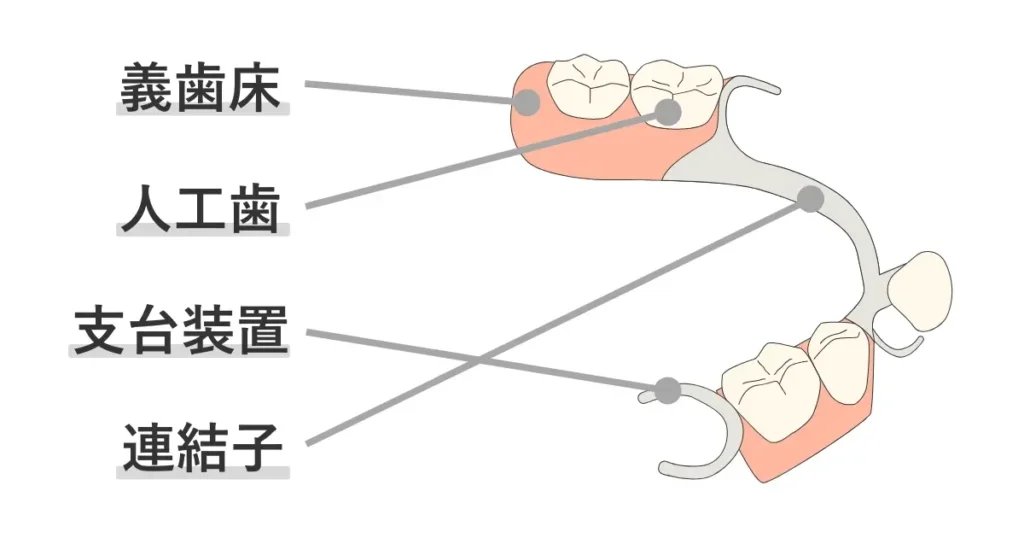 入れ歯は義歯床、人工歯、支台装置、連結子からなる。