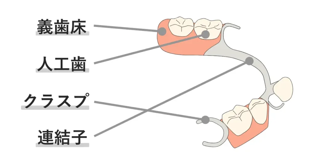 入れ歯は、義歯床、人工歯、クラスプ、連結子から構成されます。