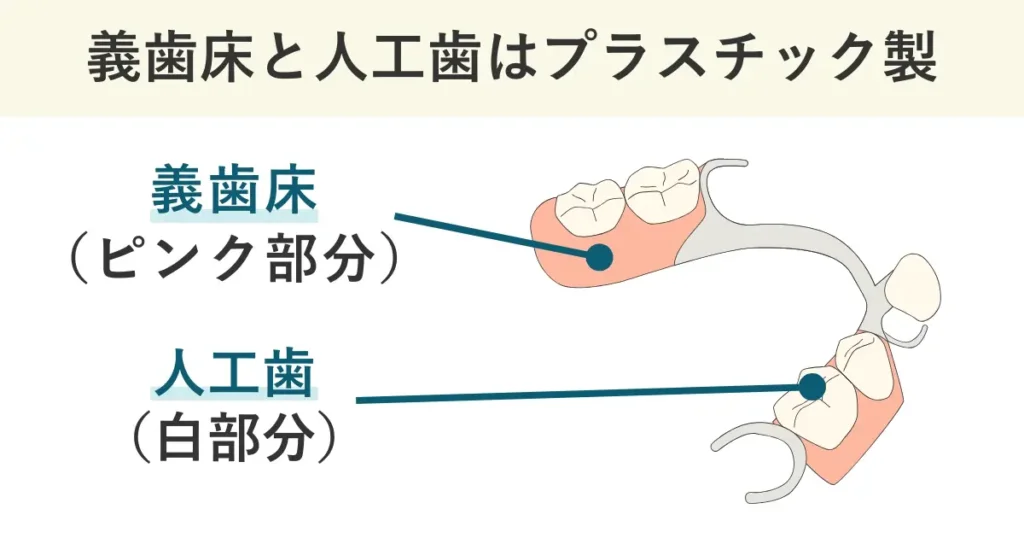 義歯床(ピンク部分)と人工歯(白部分)はプラスチックでできていて、歯よりやわらかい