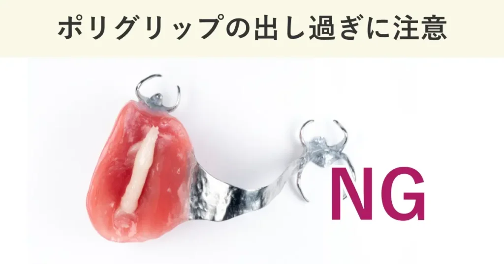 ポリグリップの使い方として間違いが多いのは、入れ歯安定剤の出し過ぎである。
