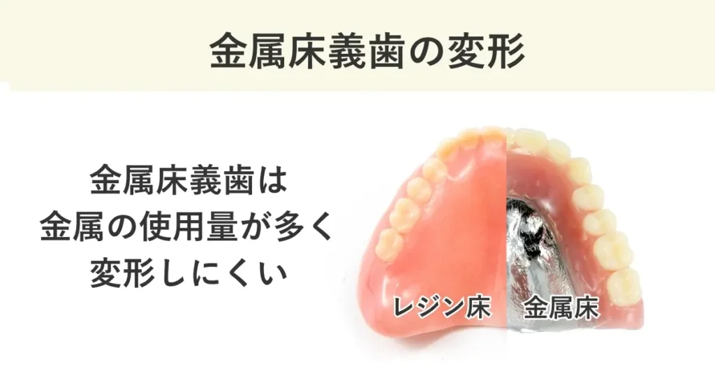 金属床義歯は金属の使用量が多いため、乾燥による変形が起こりにくいです。