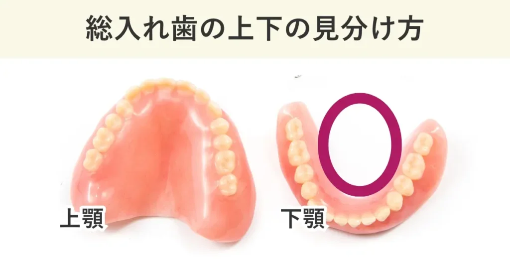 上の総入れ歯は口蓋が覆われています。下の総入れは舌側が開いています。