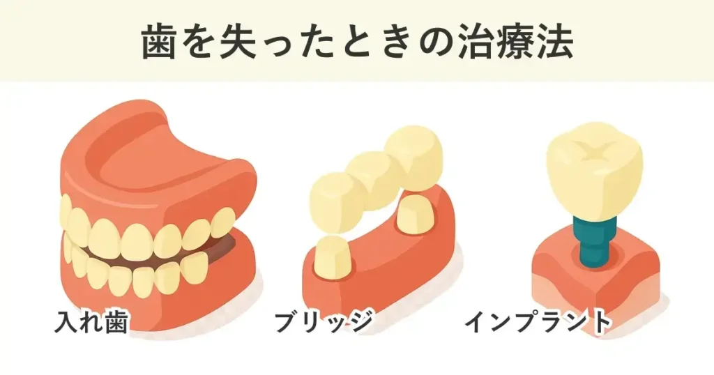 歯を失った場合の治療法は、部分入れ歯、総入れ歯、ブリッジ、インプラントがあります。