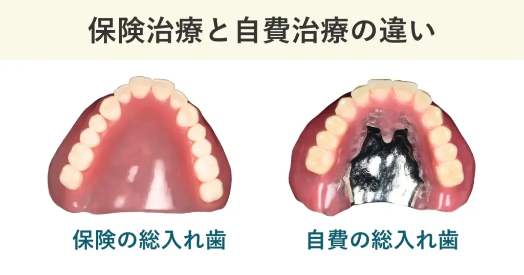 保険治療と自費治療における総入れ歯の違い