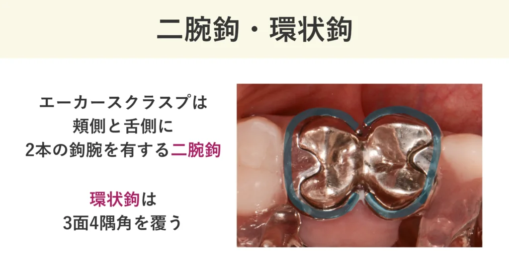 エーカースクラスプは頬側と舌側に2本の鉤腕を有する二腕鉤。環状鉤は3面4隅角を覆うクラスプです。